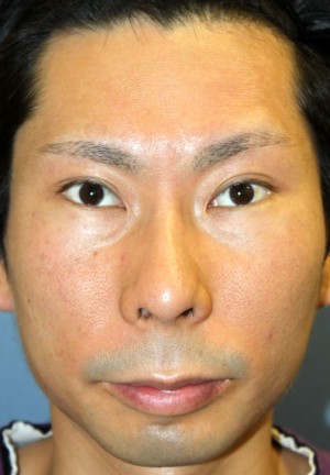 po6M正面