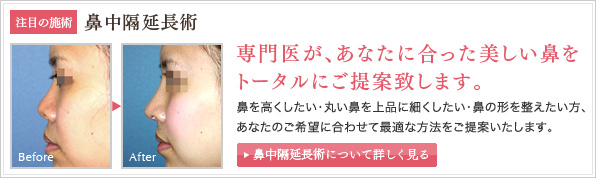 注目の施術 鼻中隔延長術