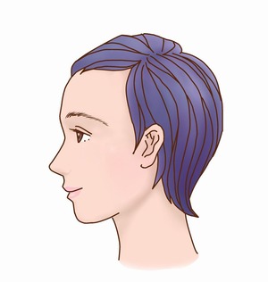 前額部形成術④