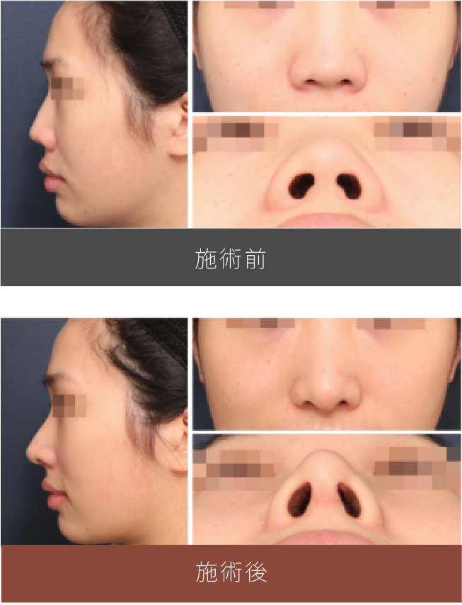 施術前後の比較