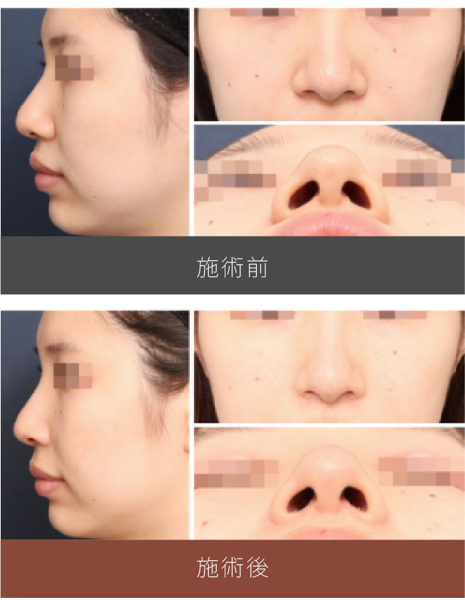 施術前後の比較