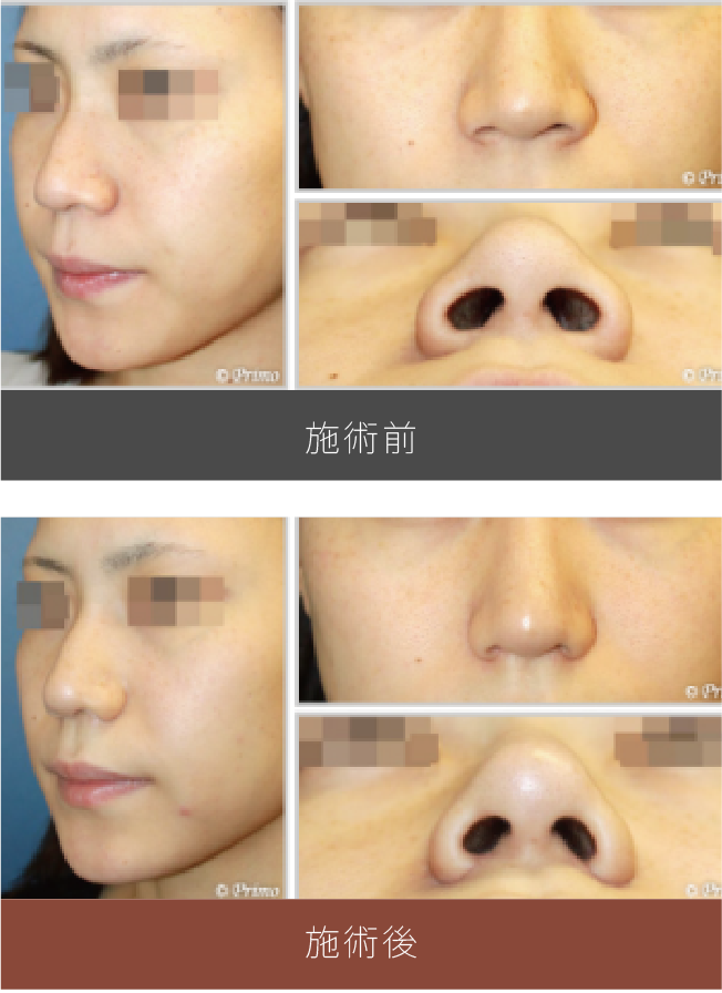 施術前後の比較