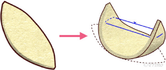 鼻翼修正術症状