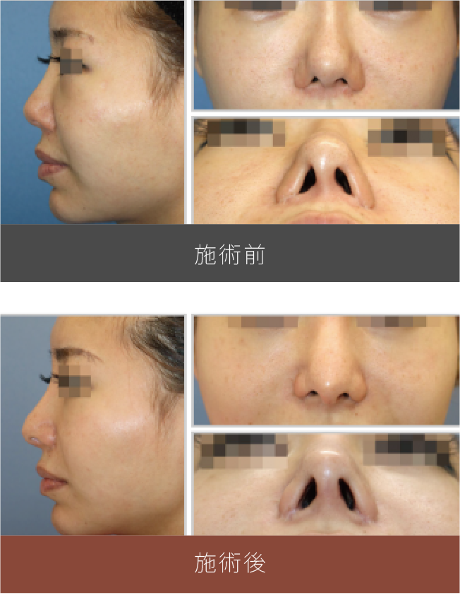 施術前後の比較