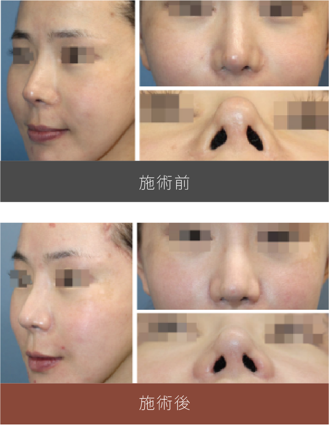 施術前後の比較