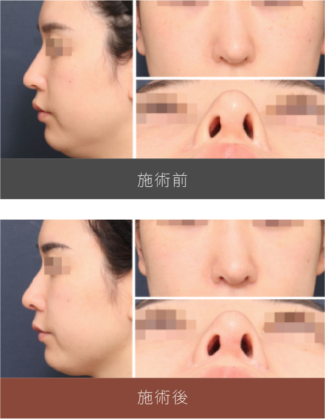 施術前後の比較