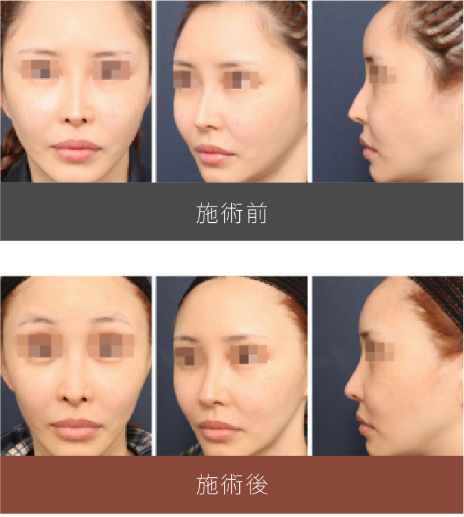 施術前後の比較