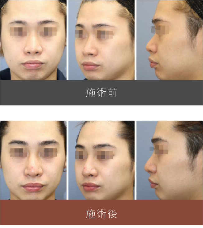 施術前後の比較
