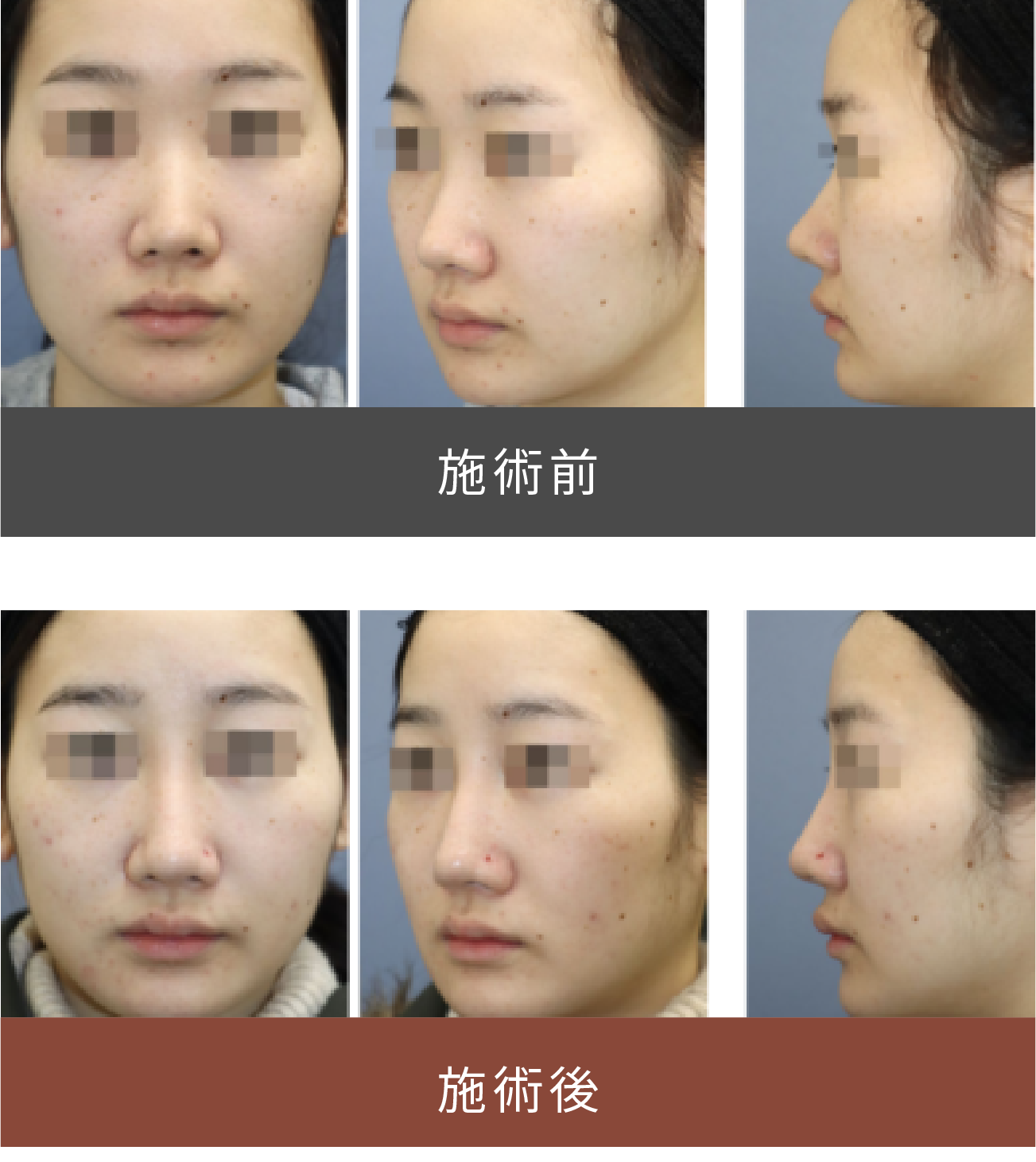 施術前後の比較