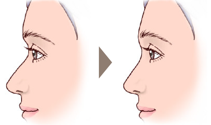 施術前後イメージ