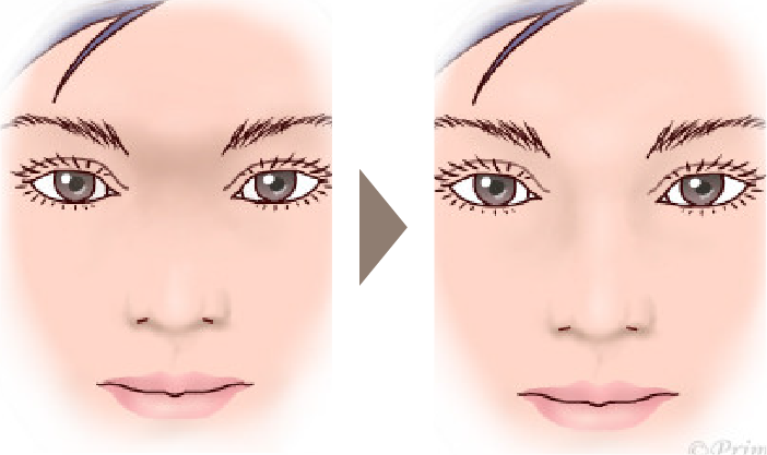 施術前後イメージ