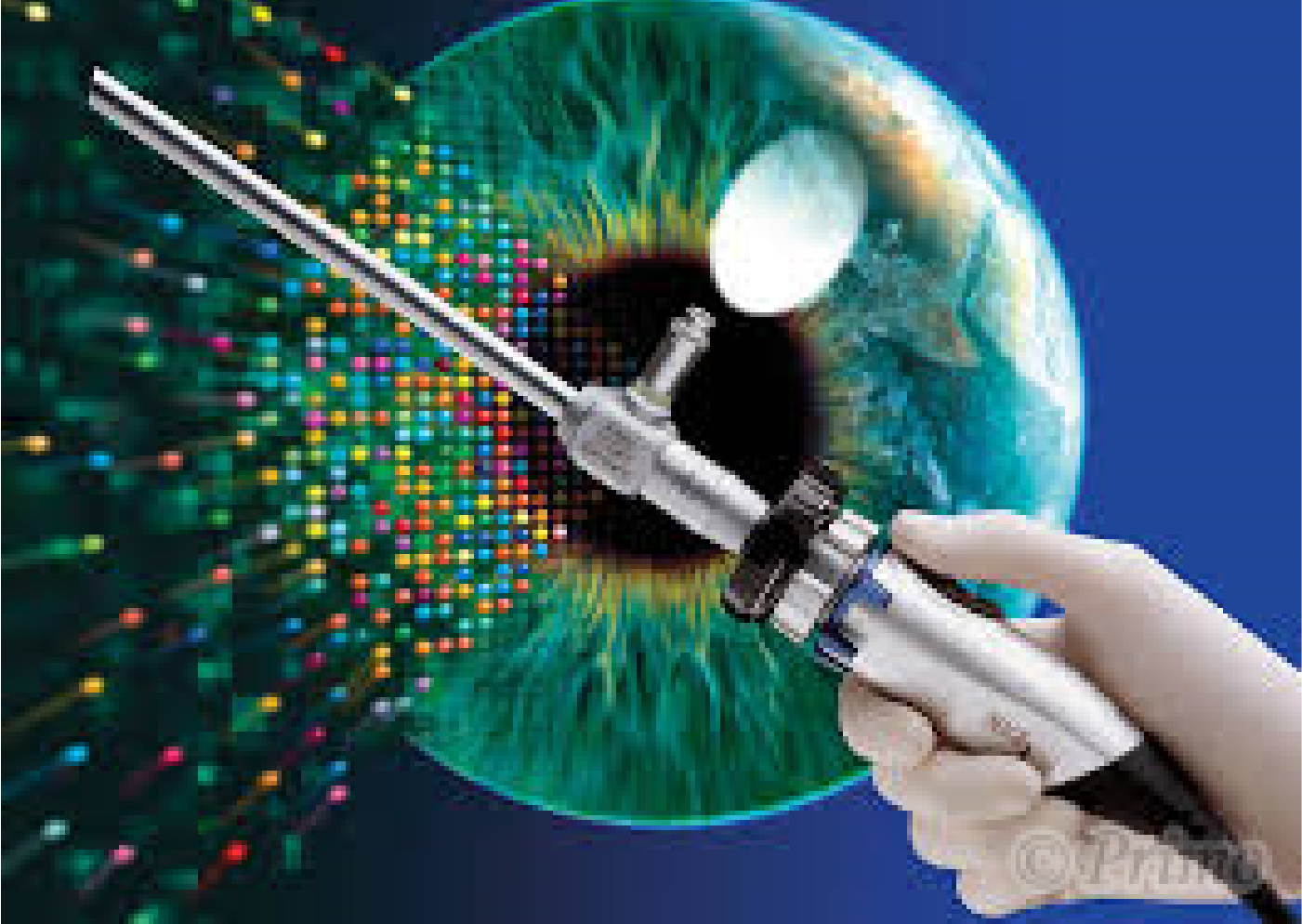 内視鏡による眉間プロテーゼのイメージ