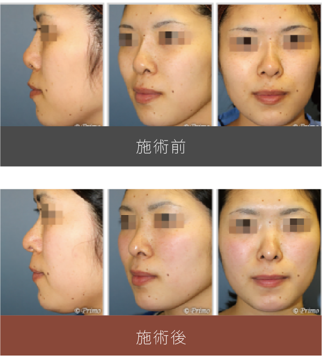 施術前後の比較