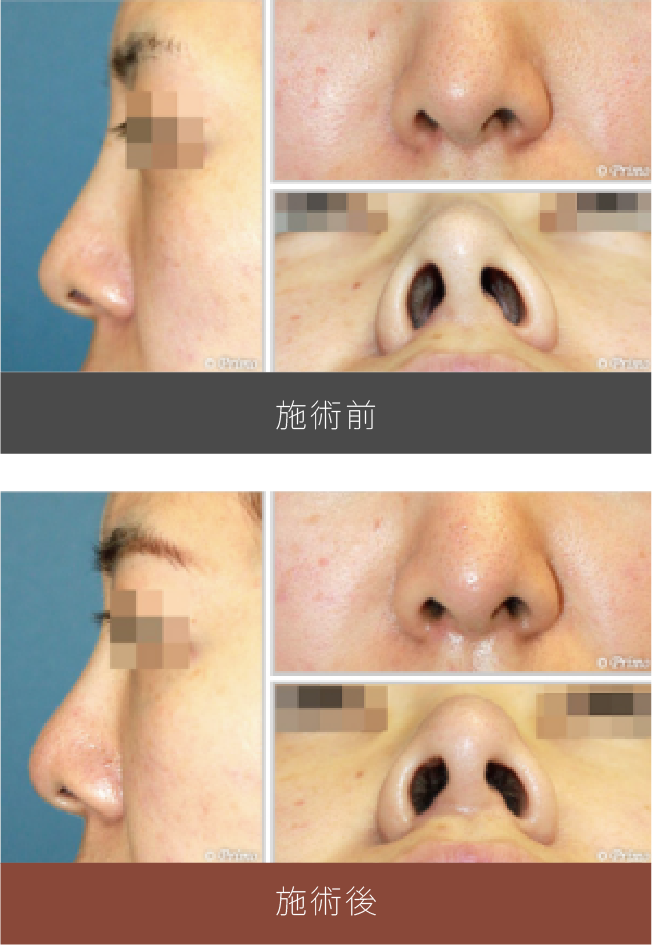 施術前後の比較