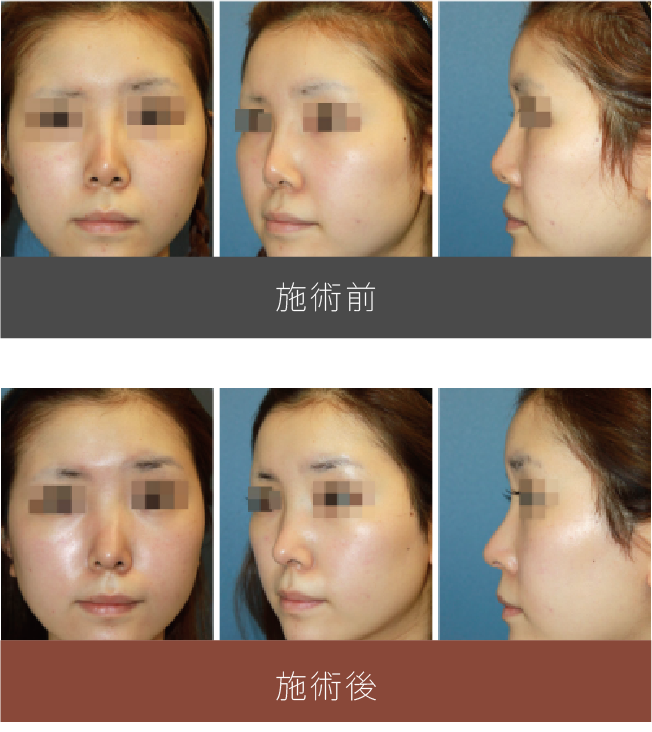 施術前後の比較