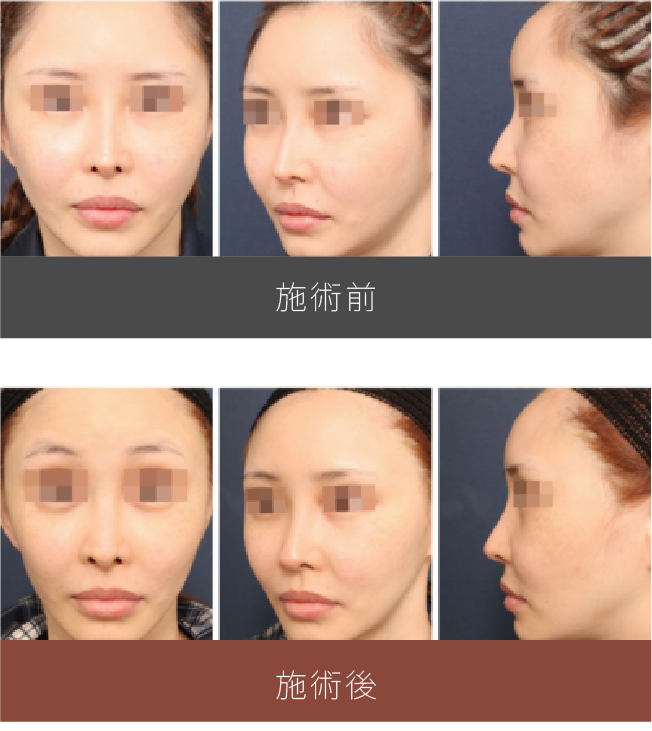 施術前後の比較