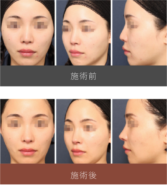 施術前後の比較