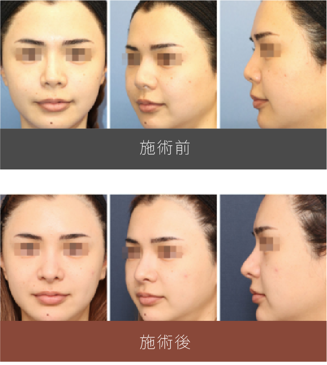 施術前後の比較