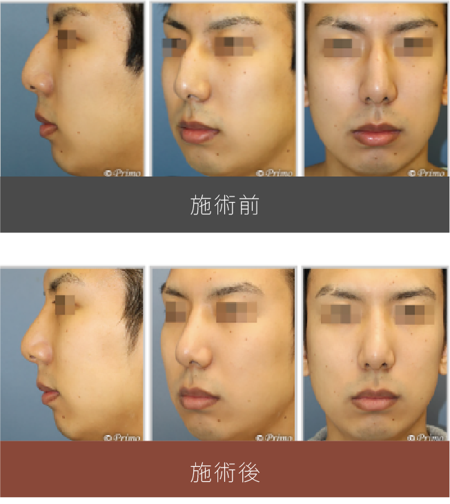 施術前後の比較