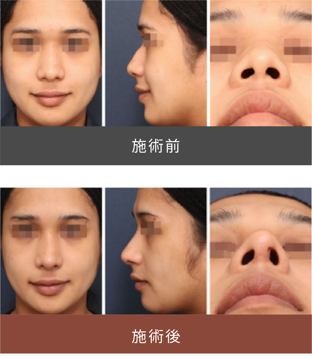 施術前後の比較