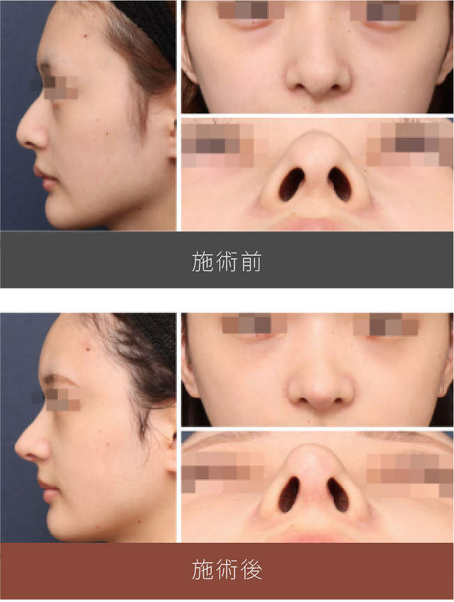 施術前後の比較