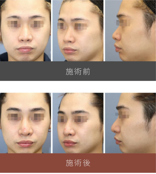 施術前後の比較