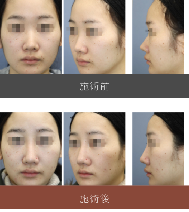 施術前後の比較