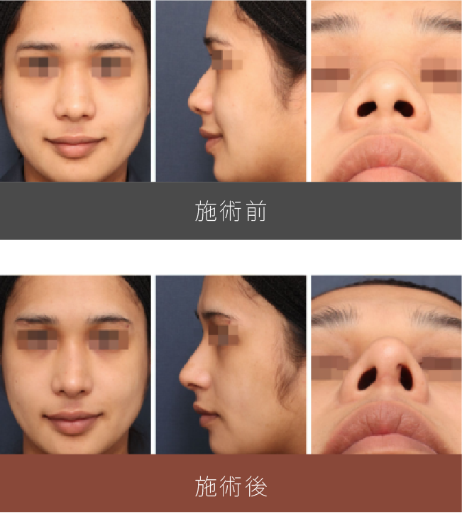 施術前後の比較