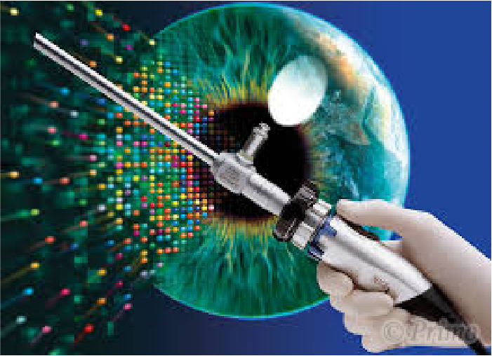 内視鏡による鼻中隔矯正術のイメージ