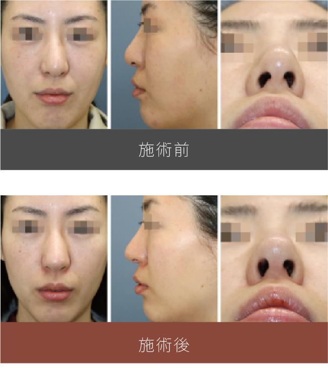 施術前後の比較