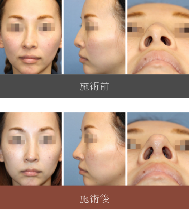施術前後の比較