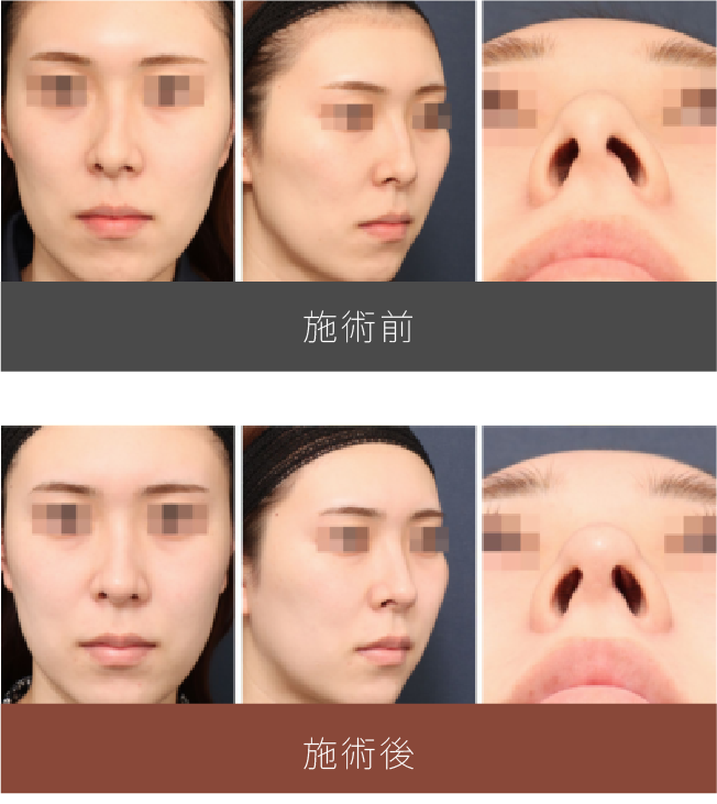 施術前後の比較