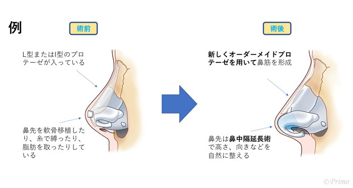 施術前後の比較