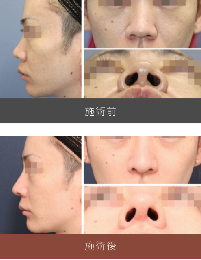 施術前後の比較