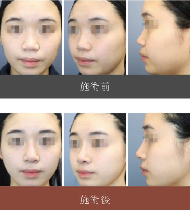 施術前後の比較