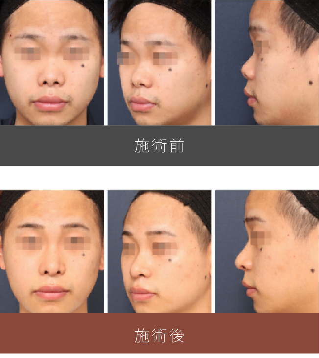 施術前後の比較
