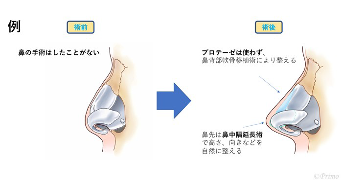 施術前後の比較