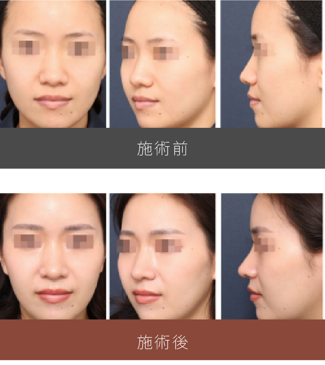 施術前後の比較
