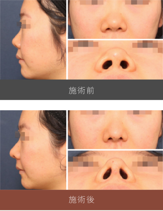 施術前後の比較