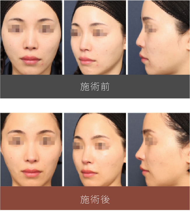 施術前後の比較