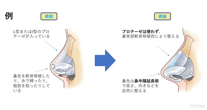 施術前後の比較