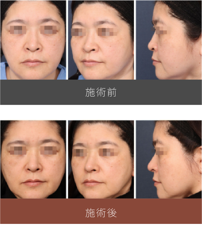 施術前後の比較
