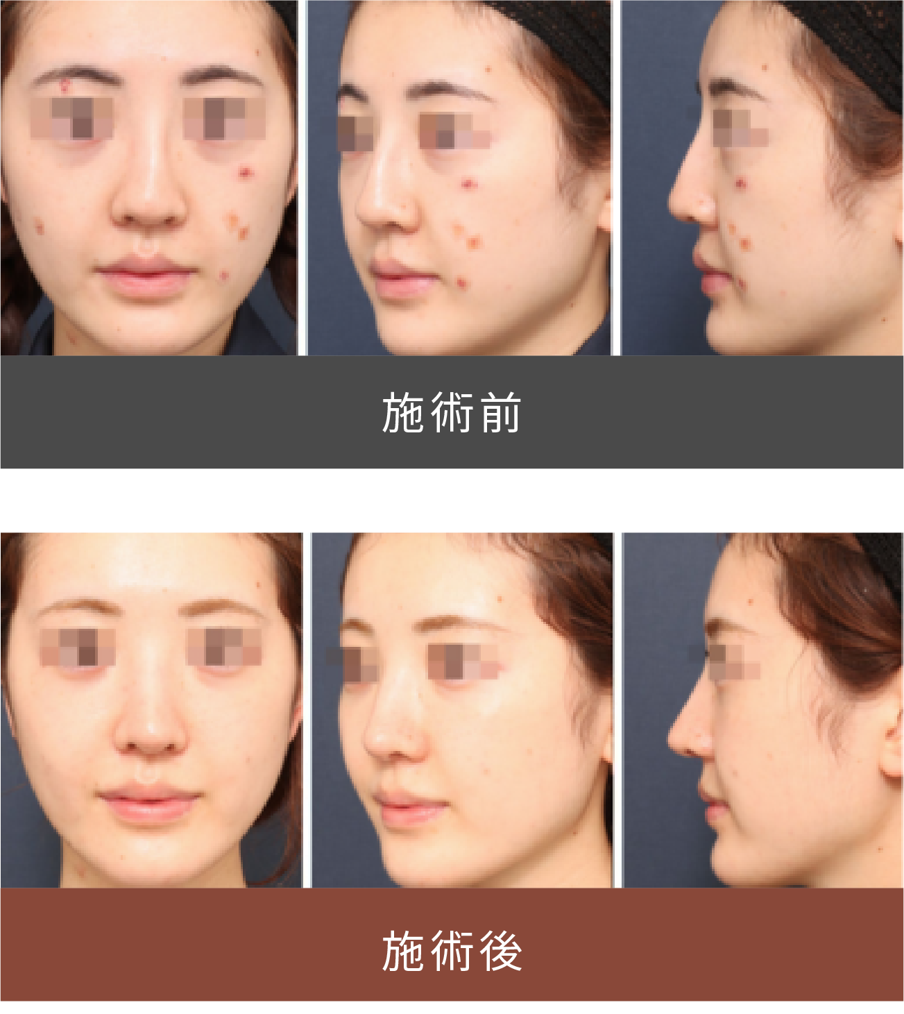 施術前後の比較