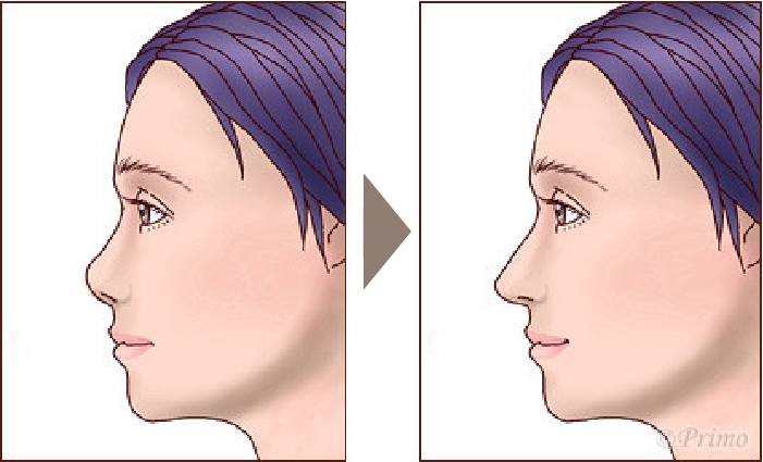 施術前後イメージ
