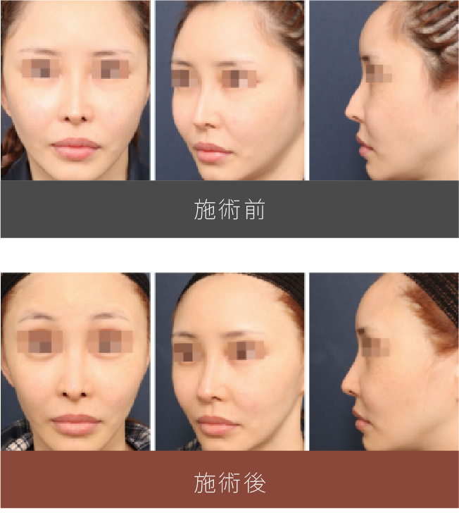 施術前後の比較