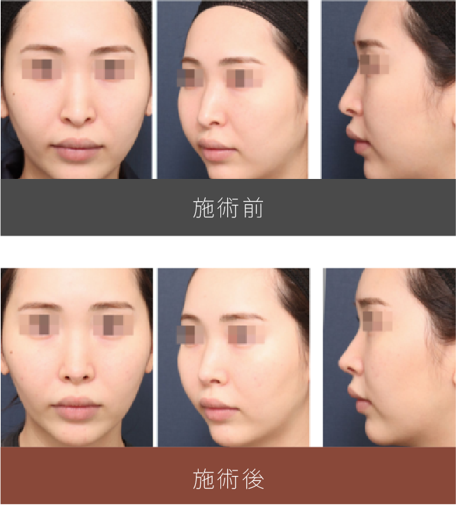 施術前後の比較