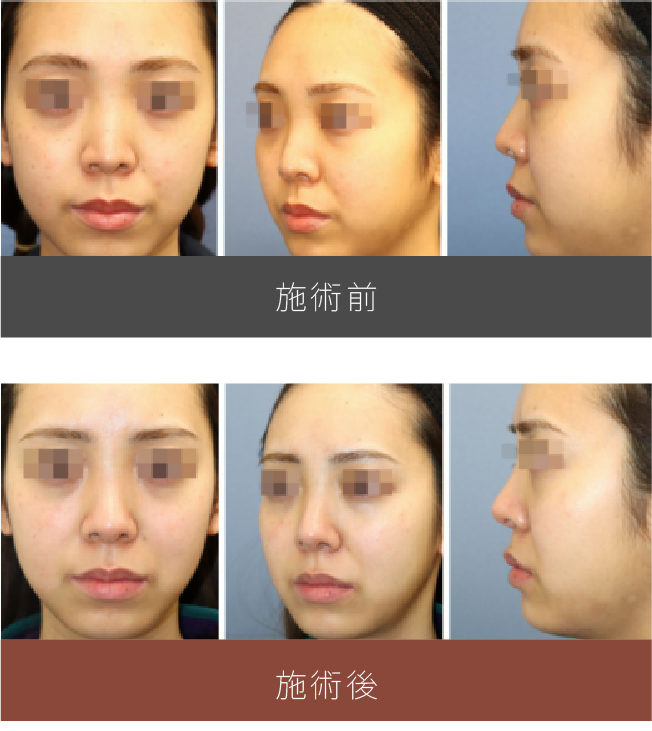 施術前後の比較