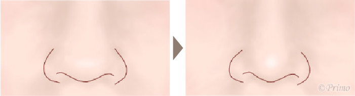 施術前後イメージ