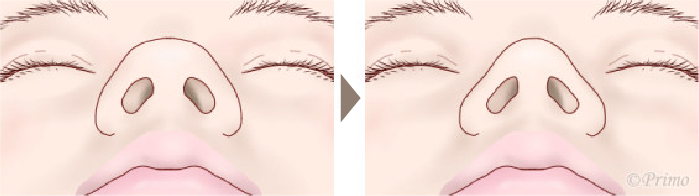 施術前後イメージ