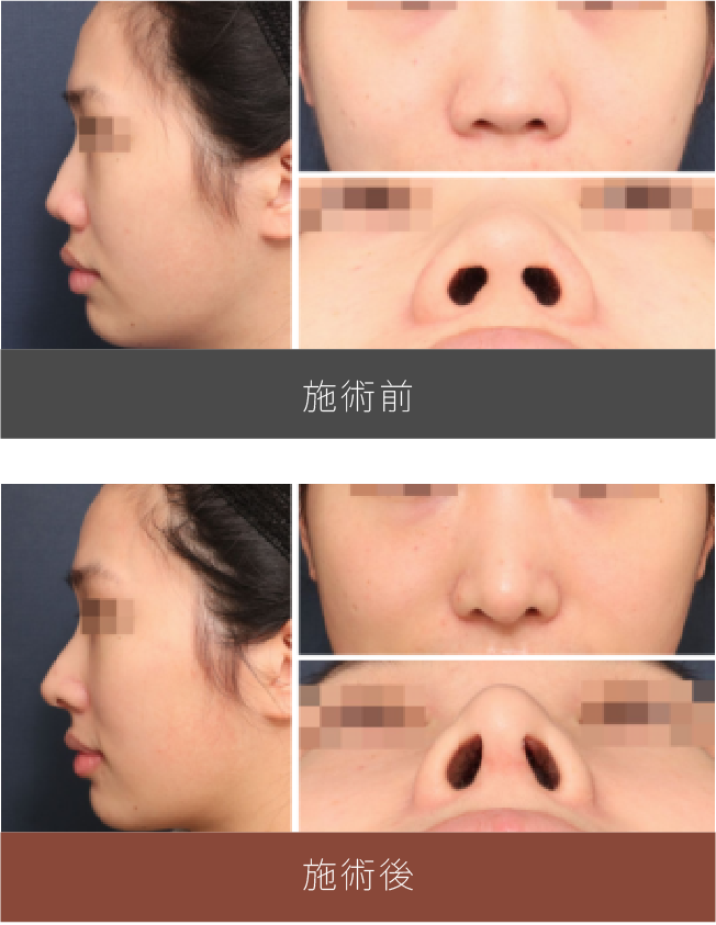 施術前後の比較
